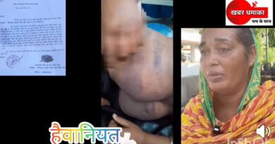 हे राम! इंसानियत तार-तार,पेड़ से लीची तोड़ने पर बच्चे की नंगा करके बेरहमी से पिटाई।तीन दिन तक हाथ पर हाथ धरे बैठे रही पुलिस।शोसल मीडिया में मामला आने के दर्ज हुआ मुकदमा 